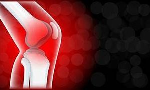 Allègement (inflammation et rhumatisme)